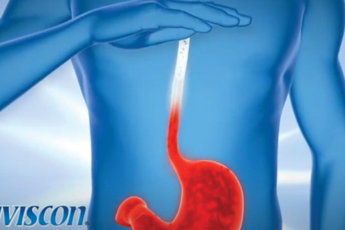 Causes of Acid Reflux & Heartburn Gaviscon®